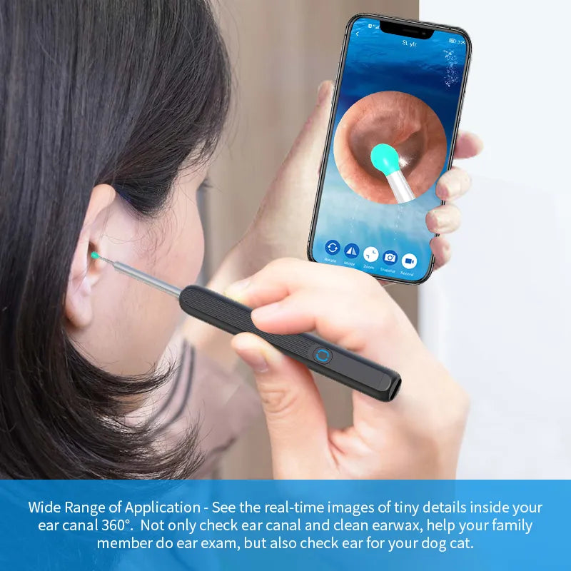 Smart Visual Ear Cleaner with HD Camera &amp; LED Lights | Safe &amp; Precise Ear Wax Removal
