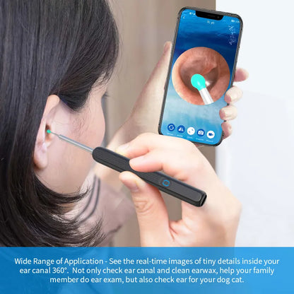 Smart Visual Ear Cleaner with HD Camera &amp; LED Lights | Safe &amp; Precise Ear Wax Removal