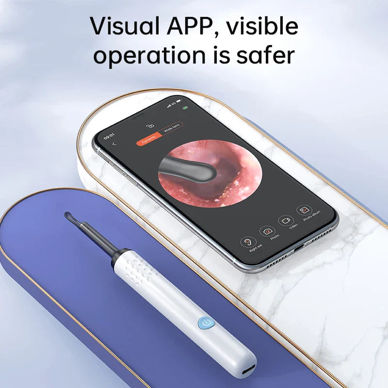 Smart Visual Ear Cleaner with HD Camera &amp; LED Lights | Safe &amp; Precise Ear Wax Removal