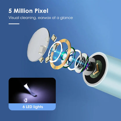 Smart Visual Ear Cleaner with HD Camera &amp; LED Lights | Safe &amp; Precise Ear Wax Removal
