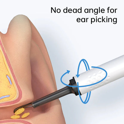 Smart Visual Ear Cleaner with HD Camera &amp; LED Lights | Safe &amp; Precise Ear Wax Removal